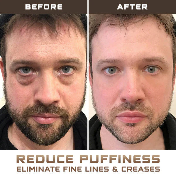 Men PRO Hydra Energetic Eye Roller