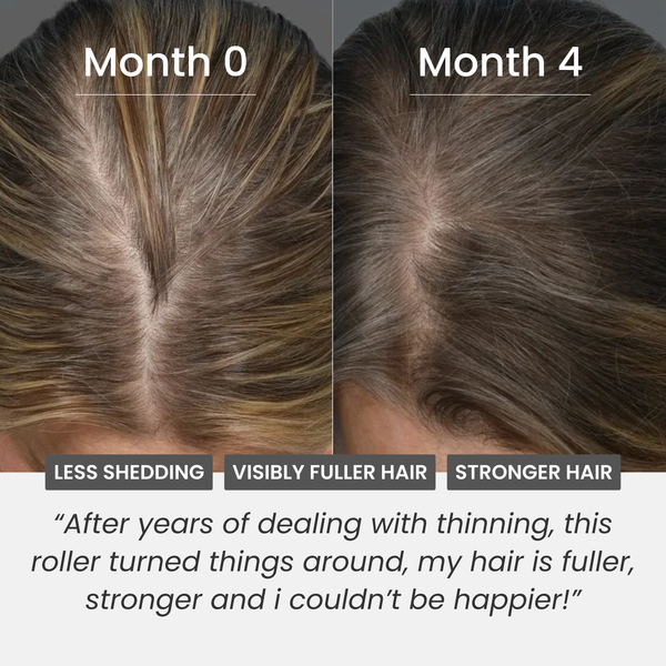 Hair Growth Boost Roller